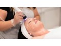 affordable-oxygeneo-facial-in-surrey-book-today-small-0